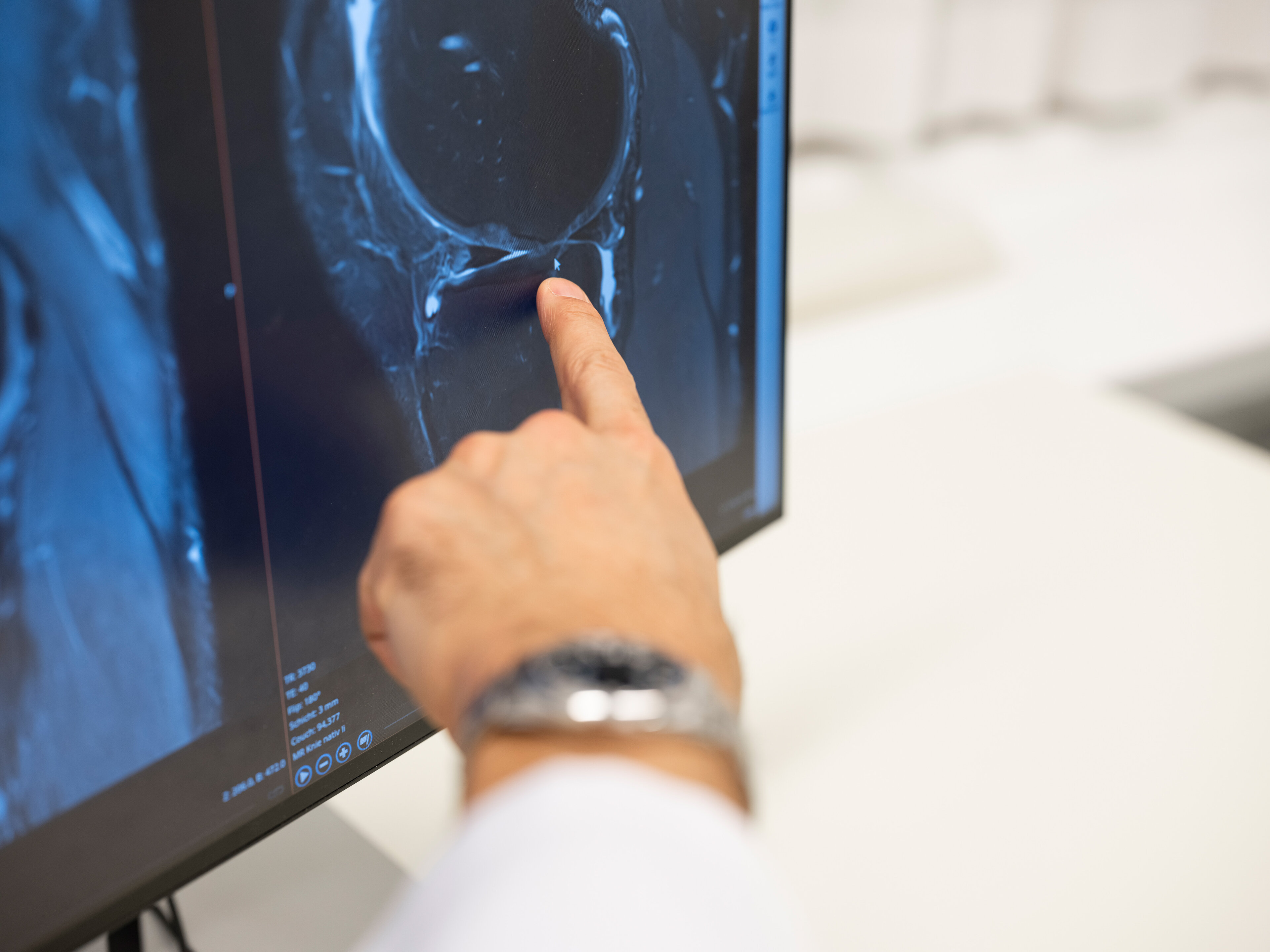 Komplexe Knieprobleme erfordern den gezielten Einsatz bildgebender Verfahren.